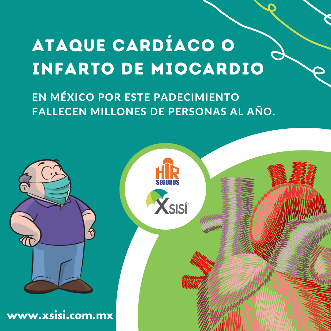 ATAQUE CARDÍACO O INFARTO DE MIOCARDIO.